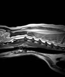MRI